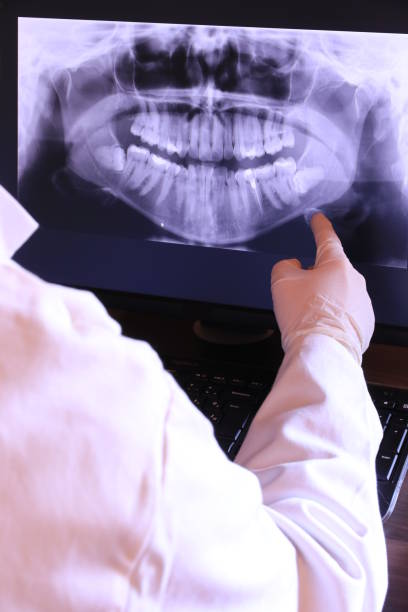 Best Emergency Dental Care for Abscessed Tooth in Charlevoix, MI