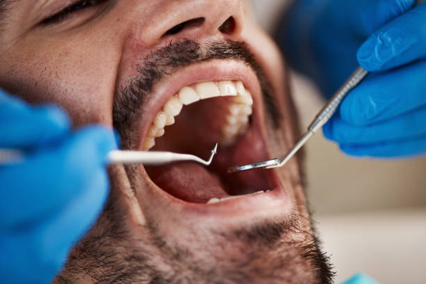 Best Emergency Dentist for Special Needs Patients in Charlevoix, MI